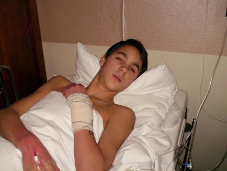 moi juste apres mon operation au poigne gauche